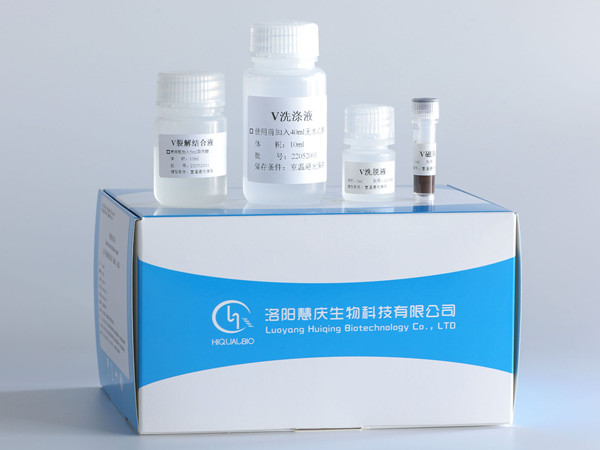 磁珠法核酸提取試劑的應用范圍和優勢